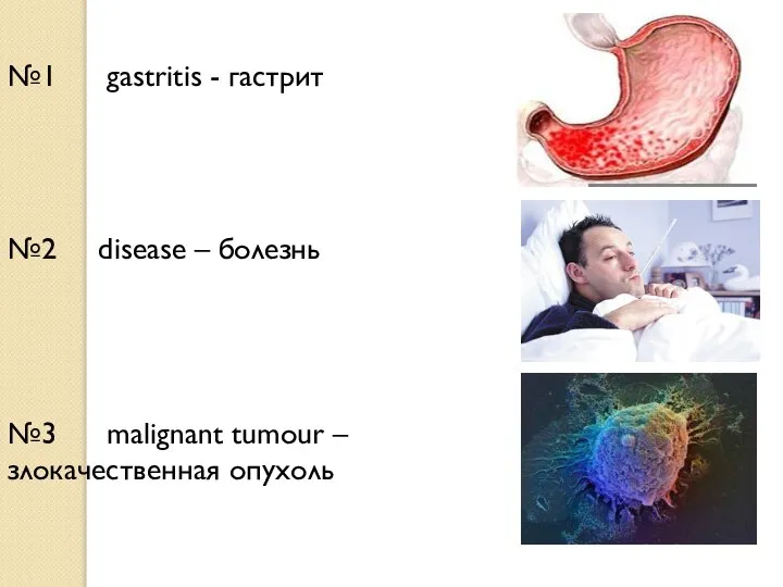 №2 disease – болезнь №3 malignant tumour – злокачественная опухоль №1 gastritis - гастрит