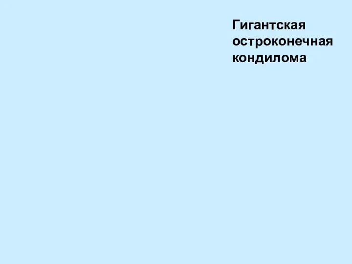 Гигантская остроконечная кондилома