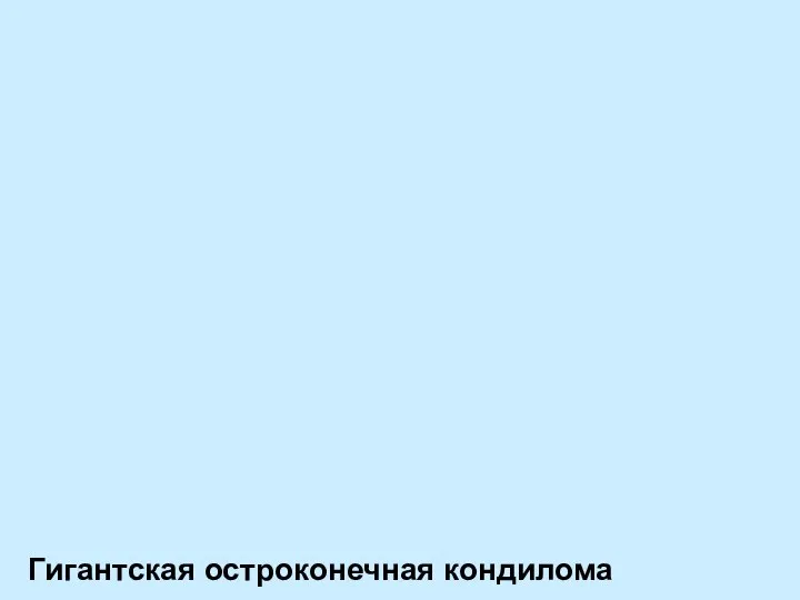 Гигантская остроконечная кондилома