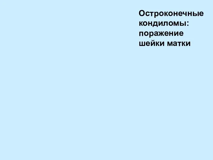 Остроконечные кондиломы: поражение шейки матки