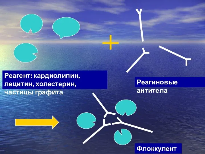 Реагент: кардиолипин, лецитин, холестерин, частицы графита Реагиновые антитела Флоккулент