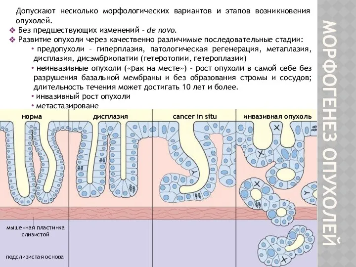 МОРФОГЕНЕЗ ОПУХОЛЕЙ Допускают несколько морфологических вариантов и этапов возникновения опухолей. Без