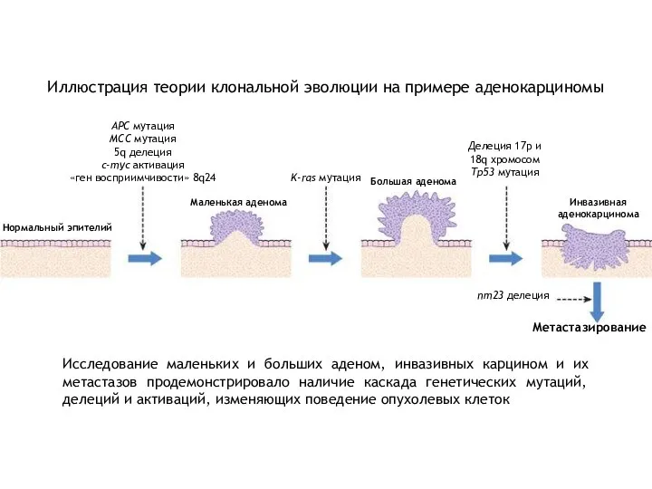 Иллюстрация теории клональной эволюции на примере аденокарциномы Нормальный эпителий Маленькая аденома