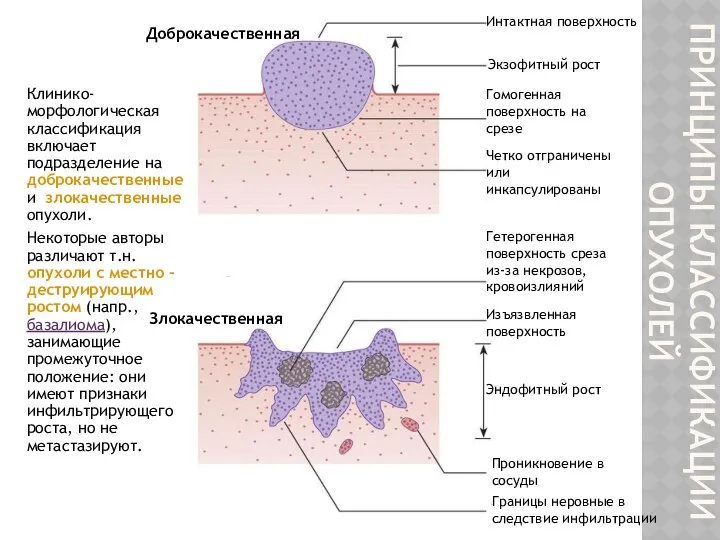 ПРИНЦИПЫ КЛАССИФИКАЦИИ ОПУХОЛЕЙ Клинико-морфологическая классификация включает подразделение на доброкачественные и злокачественные