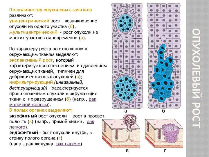 ОПУХОЛЕВЫЙ РОСТ По количеству опухолевых зачатков различают: уницентрический рост – возникновение