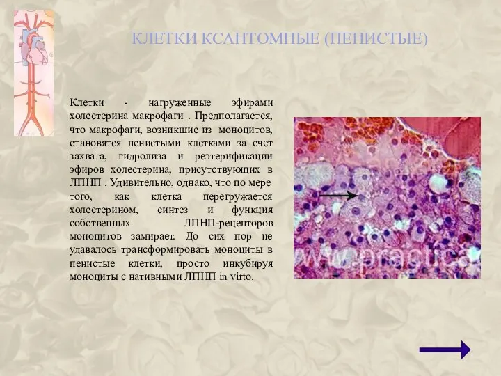 КЛЕТКИ КСАНТОМНЫЕ (ПЕНИСТЫЕ) Клетки - нагруженные эфирами холестерина макрофаги . Предполагается,