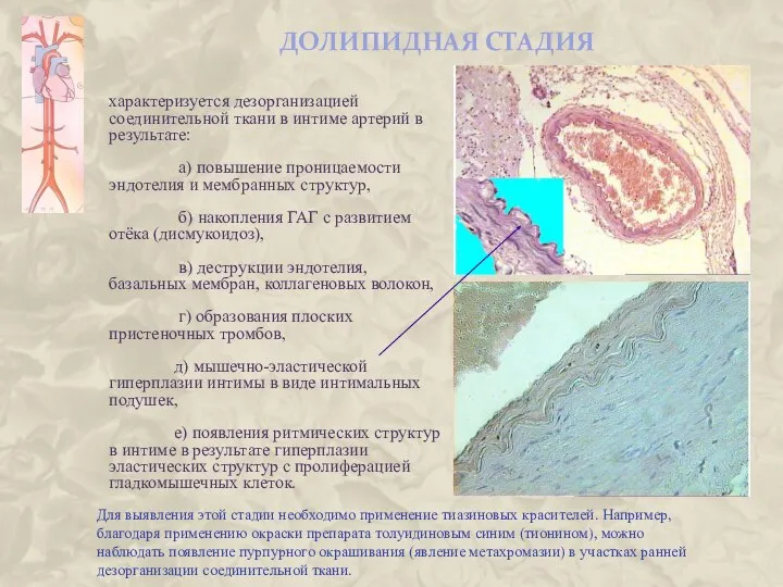 ДОЛИПИДНАЯ СТАДИЯ характеризуется дезорганизацией соединительной ткани в интиме артерий в результате: