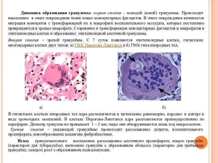 Динамика образования гранулемы: первая стадия - молодой (юной) гранулемы. Происходит накопление