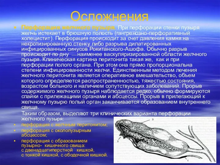 Осложнения Перфорация желчного пузыря. При перфорации стенки пузыря желчь истекает в