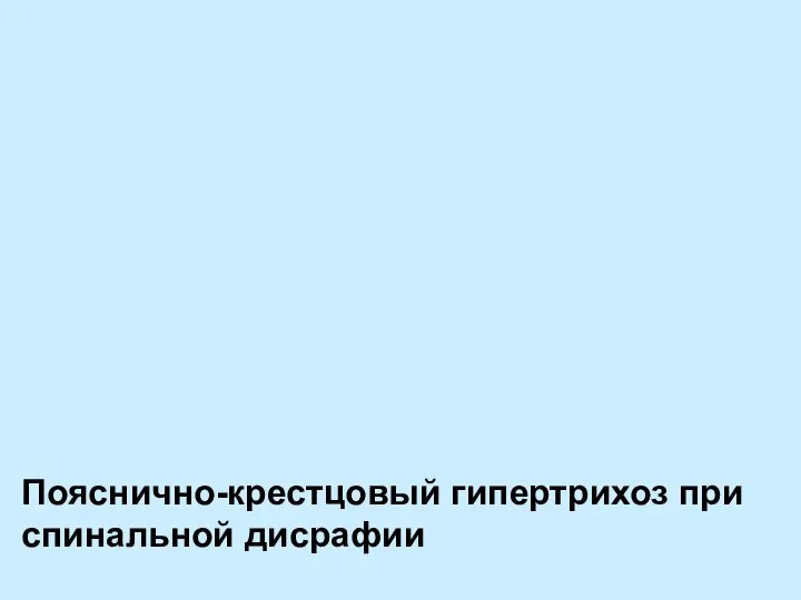 Пояснично-крестцовый гипертрихоз при спинальной дисрафии