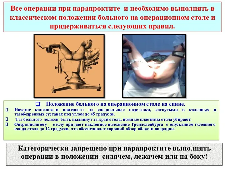 Все операции при парапроктите и необходимо выполнять в классическом положении больного