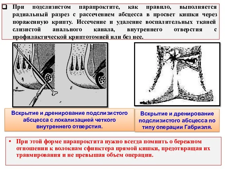 При подслизистом парапроктите, как правило, выполняется радиальный разрез с рассечением абсцесса