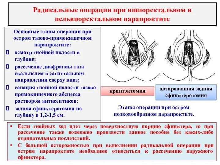 Радикальные операции при ишиоректальном и пельвиоректальном парапроктите Основные этапы операции при