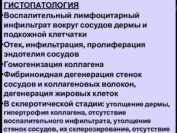 ГИСТОПАТОЛОГИЯ Воспалительный лимфоцитарный инфильтрат вокруг сосудов дермы и подкожной клетчатки Отек,