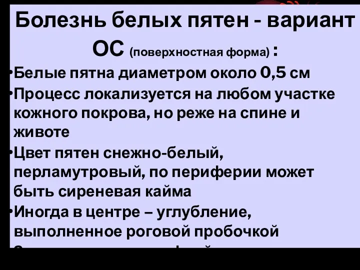 Болезнь белых пятен - вариант ОС (поверхностная форма) : Белые пятна