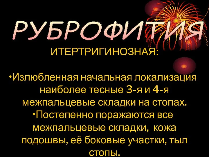 РУБРОФИТИЯ ИТЕРТРИГИНОЗНАЯ: Излюбленная начальная локализация наиболее тесные 3-я и 4-я межпальцевые