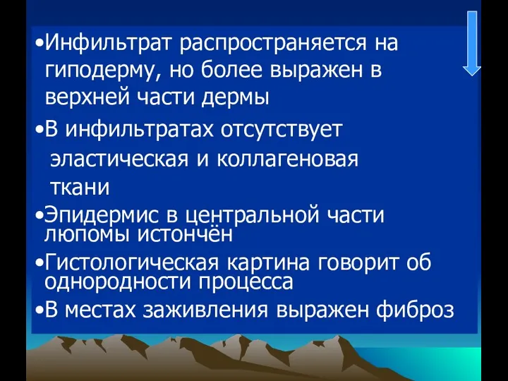 Инфильтрат распространяется на гиподерму, но более выражен в верхней части дермы