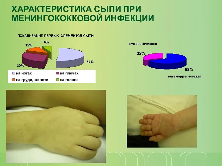 ХАРАКТЕРИСТИКА СЫПИ ПРИ МЕНИНГОКОККОВОЙ ИНФЕКЦИИ