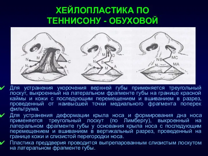 ХЕЙЛОПЛАСТИКА ПО ТЕННИСОНУ - ОБУХОВОЙ Для устранения укорочения верхней губы применяется