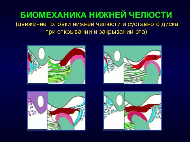 БИОМЕХАНИКА НИЖНЕЙ ЧЕЛЮСТИ (движение головки нижней челюсти и суставного диска при открывании и закрывании рта)