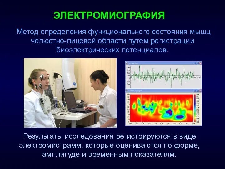 ЭЛЕКТРОМИОГРАФИЯ Результаты исследования регистрируются в виде электромиограмм, которые оцениваются по форме,