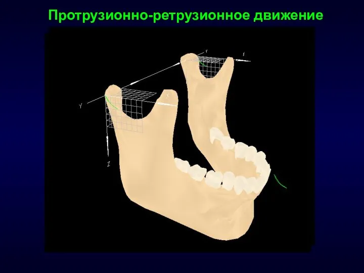 Протрузионно-ретрузионное движение