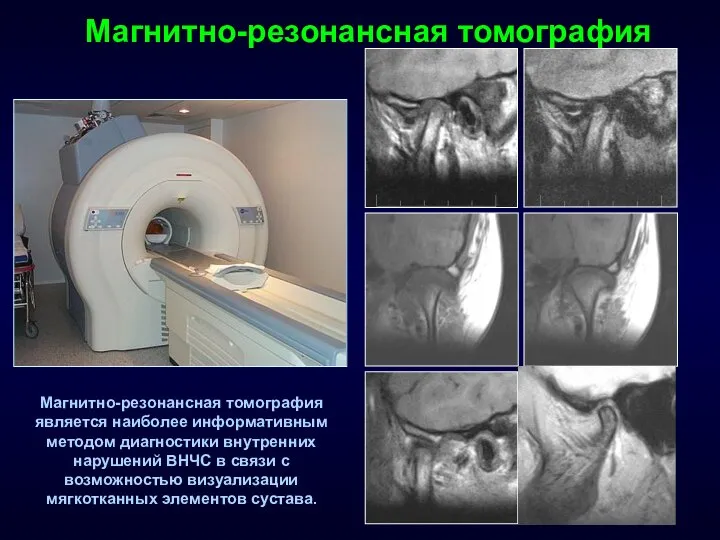 Магнитно-резонансная томография Магнитно-резонансная томография является наиболее информативным методом диагностики внутренних нарушений