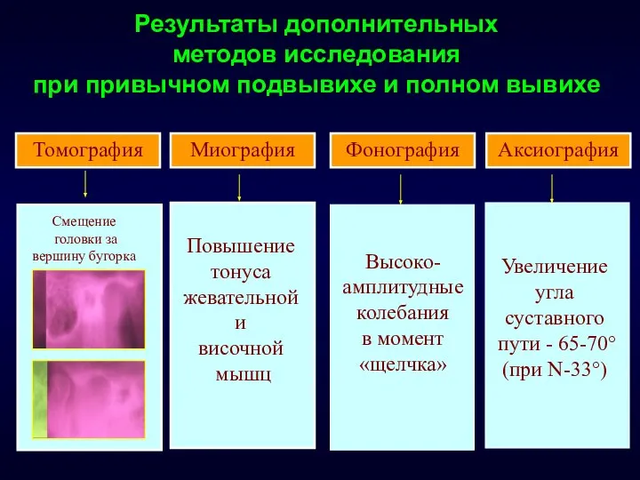 Результаты дополнительных методов исследования при привычном подвывихе и полном вывихе Томография