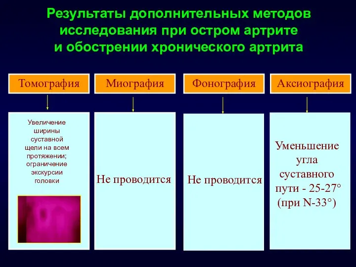 Результаты дополнительных методов исследования при остром артрите и обострении хронического артрита