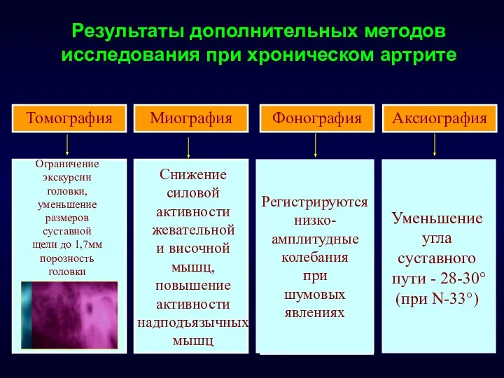 Результаты дополнительных методов исследования при хроническом артрите Томография Миография Фонография Аксиография