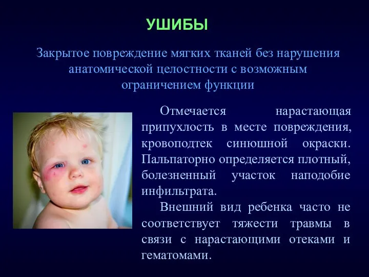 Закрытое повреждение мягких тканей без нарушения анатомической целостности с возможным ограничением