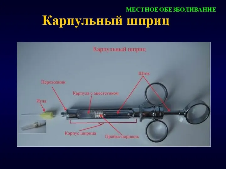 Карпульный шприц МЕСТНОЕ ОБЕЗБОЛИВАНИЕ