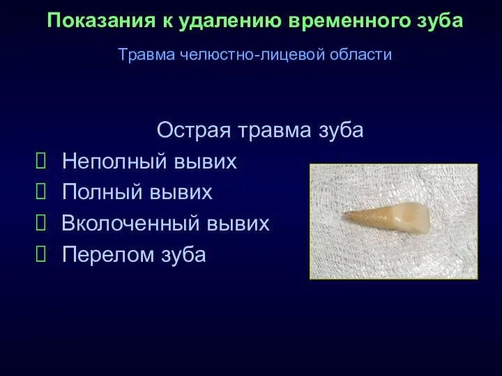 Показания к удалению временного зуба Травма челюстно-лицевой области Острая травма зуба