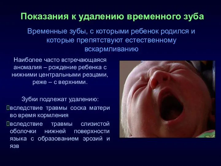 Показания к удалению временного зуба Наиболее часто встречающаяся аномалия – рождение