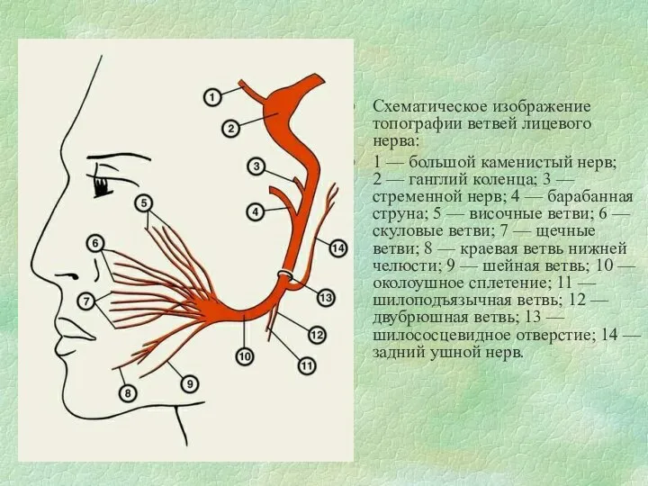 Схематическое изображение топографии ветвей лицевого нерва: 1 — большой каменистый нерв;