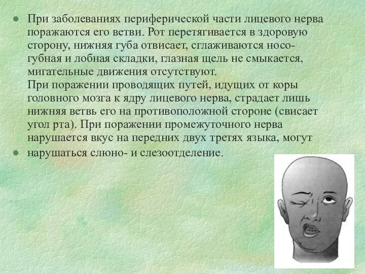 При заболеваниях периферической части лицевого нерва поражаются его ветви. Рот перетягивается