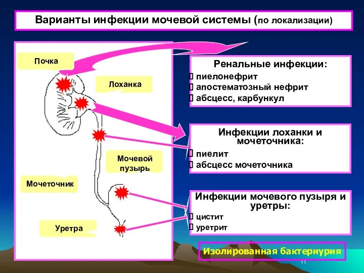 Изолированная бактериурия