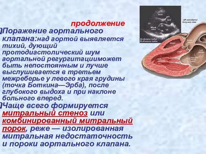 продолжение Поражение аортального клапана:над аортой выявляется тихий, дующий протодиастолический шум аортальной