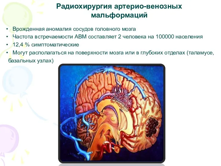 Врожденная аномалия сосудов головного мозга Частота встречаемости АВМ составляет 2 человека