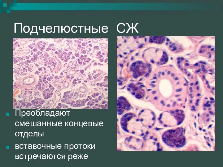 Подчелюстные СЖ Преобладают смешанные концевые отделы вставочные протоки встречаются реже