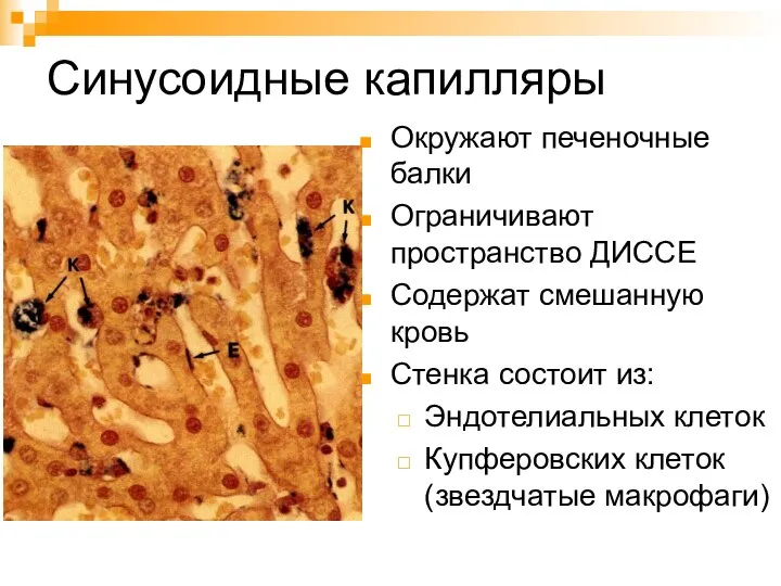 Синусоидные капилляры Окружают печеночные балки Ограничивают пространство ДИССЕ Содержат смешанную кровь