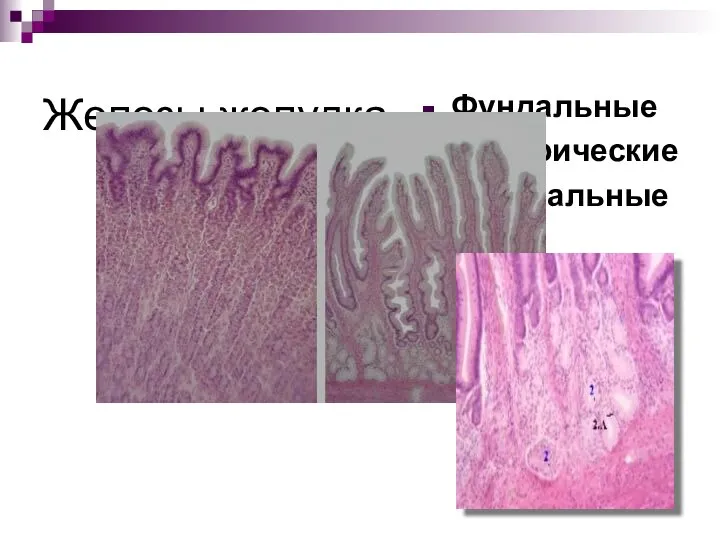 Железы желудка Фундальные Пилорические Кардиальные