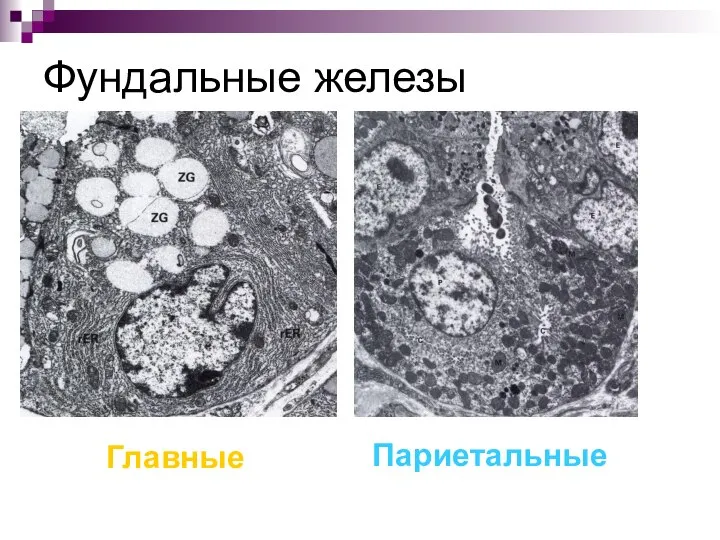 Фундальные железы Главные Париетальные