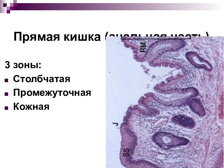 Прямая кишка (анальная часть) 3 зоны: Столбчатая Промежуточная Кожная