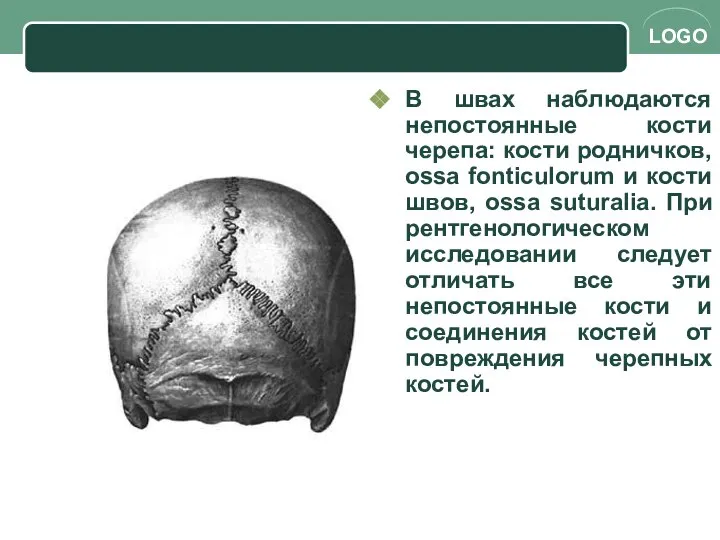 В швах наблюдаются непостоянные кости черепа: кости родничков, ossa fonticulorum и