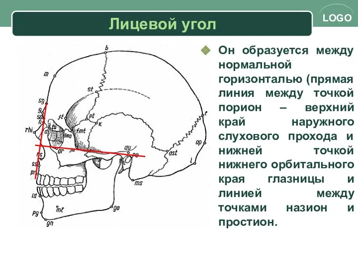 Лицевой угол Он образуется между нормальной горизонталью (прямая линия между точкой