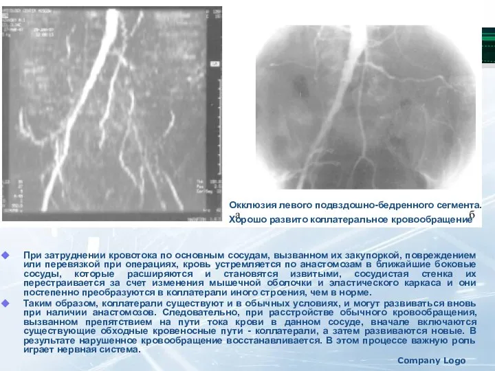 Konovalova S. G. Company Logo При затруднении кровотока по основным сосудам,