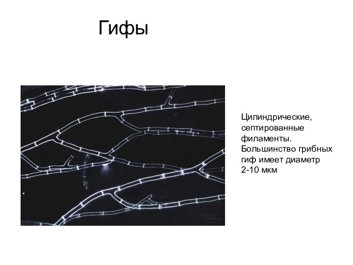 Гифы Цилиндрические, септированные филаменты. Большинство грибных гиф имеет диаметр 2-10 мкм