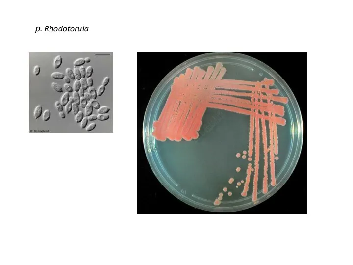 р. Rhodotorula