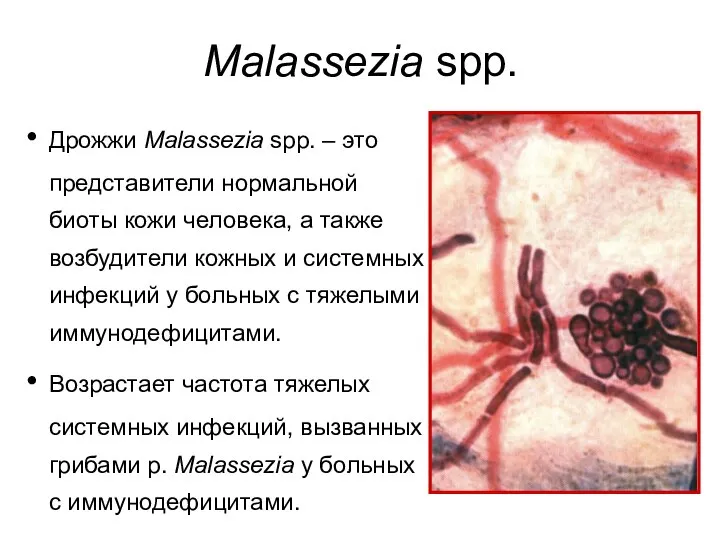 Malassezia spp. Дрожжи Malassezia spp. – это представители нормальной биоты кожи